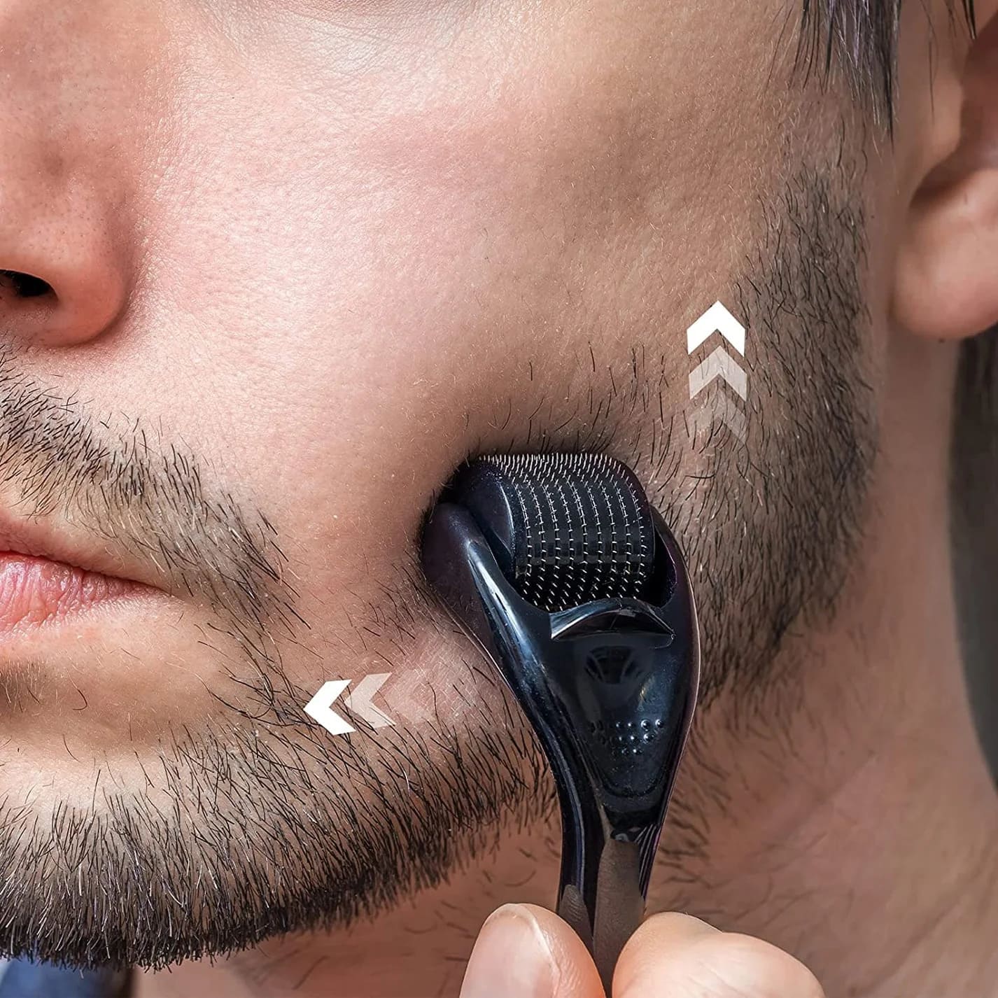 MINOXIDIL LIQUIDO